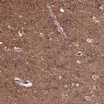 TUBA1A Antibody in Immunohistochemistry (IHC)