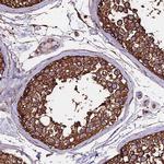 TUBA1A Antibody in Immunohistochemistry (IHC)