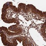 TUBA1A Antibody in Immunohistochemistry (IHC)