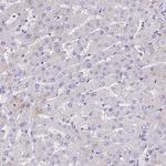 TUBA1A Antibody in Immunohistochemistry (IHC)