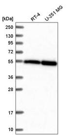 TUBA1A Antibody in Western Blot (WB)