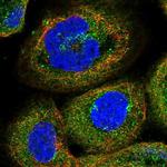 PEX5 Antibody in Immunocytochemistry (ICC/IF)