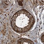 PEX5 Antibody in Immunohistochemistry (IHC)