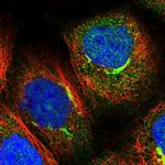 PEX5 Antibody in Immunocytochemistry (ICC/IF)