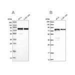 PEX5 Antibody in Western Blot (WB)