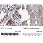 TRAFD1 Antibody in Immunohistochemistry (IHC)