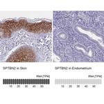 Spectrin beta-3 Antibody in Immunohistochemistry (IHC)