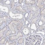 HVCN1 Antibody in Immunohistochemistry (IHC)