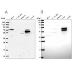 ACSS3 Antibody in Western Blot (WB)