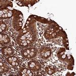 LCMT2 Antibody in Immunohistochemistry (IHC)