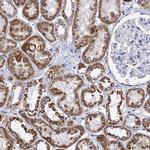 CCP110 Antibody in Immunohistochemistry (IHC)