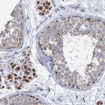 CCP110 Antibody in Immunohistochemistry (IHC)