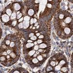 SUCLA2 Antibody in Immunohistochemistry (IHC)