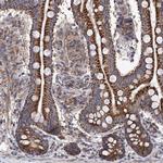 SUCLA2 Antibody in Immunohistochemistry (IHC)