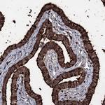 OGFOD2 Antibody in Immunohistochemistry (IHC)