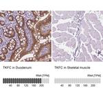 DAK Antibody in Immunohistochemistry (IHC)