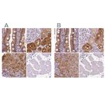 DAK Antibody in Immunohistochemistry (IHC)