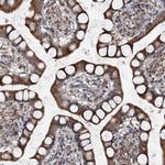 TAPBPL Antibody in Immunohistochemistry (IHC)