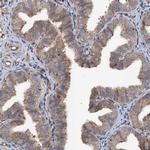 TAPBPL Antibody in Immunohistochemistry (IHC)