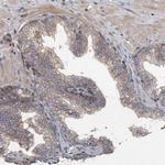 TAPBPL Antibody in Immunohistochemistry (IHC)