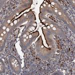 TAPBPL Antibody in Immunohistochemistry (IHC)