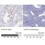 SCP3 Antibody in Immunohistochemistry (IHC)