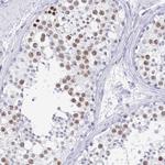 SCP3 Antibody in Immunohistochemistry (IHC)