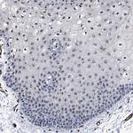 EMG1 Antibody in Immunohistochemistry (IHC)