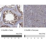 C10orf88 Antibody in Immunohistochemistry (IHC)