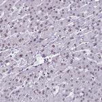 MPP8 Antibody in Immunohistochemistry (IHC)