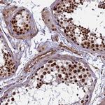 MPP8 Antibody in Immunohistochemistry (IHC)