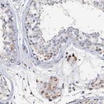 VPS36 Antibody in Immunohistochemistry (IHC)