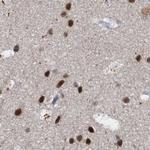 CSTF3 Antibody in Immunohistochemistry (IHC)