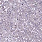 SELT Antibody in Immunohistochemistry (IHC)