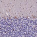 SELT Antibody in Immunohistochemistry (IHC)