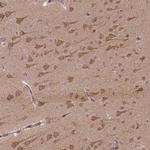 GOLGA3 Antibody in Immunohistochemistry (IHC)