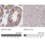 WHSC2 Antibody