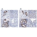 NRIP2 Antibody in Immunohistochemistry (IHC)