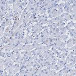 NRIP2 Antibody in Immunohistochemistry (IHC)