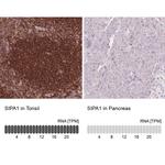 SIPA1 Antibody in Immunohistochemistry (IHC)