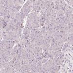 SIPA1 Antibody in Immunohistochemistry (IHC)