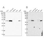 ZDHHC16 Antibody in Western Blot (WB)