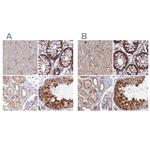 WDR61 Antibody in Immunohistochemistry (IHC)