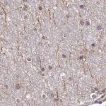 WDR61 Antibody in Immunohistochemistry (IHC)