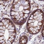 WDR61 Antibody in Immunohistochemistry (IHC)