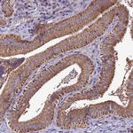 ZPK Antibody in Immunohistochemistry (IHC)