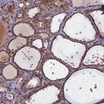 UFSP2 Antibody in Immunohistochemistry (IHC)