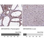 MPP8 Antibody in Immunohistochemistry (IHC)