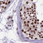 MPP8 Antibody in Immunohistochemistry (IHC)