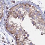 GOLGA3 Antibody in Immunohistochemistry (IHC)